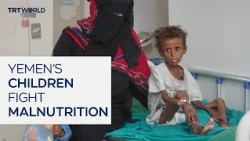Yemen’s malnutrition crisis threatens millions of children
